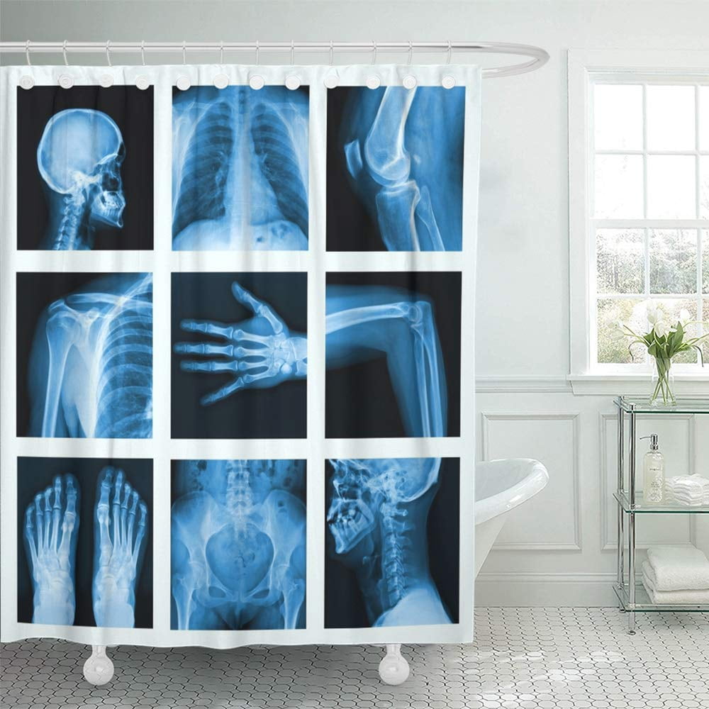 KSADK Xray Collage of Many X Rays Very Good Others Images in My