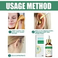 neurontin tinnitus treatment