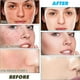 thumbnail image 5 of Set para el cuidado de la piel Aacre Turmeric Trio: jabón, espuma y jabón facial, 5 of 7