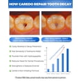 thumbnail image 2 of Pasta de dientes CAREDO Cavity Reversal Hidroxiapatita 100 ml para adultos, 2 of 4