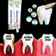 thumbnail image 2 of Eliminador de cálculo Dental, blanqueador de dientes, eliminación de olores bucales, mal aliento, prevención de Periodontitis, cuidado de la salud bucal, nuevo 2024, 2 of 5