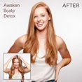 thumbnail image 2 of Surface Awaken Scalp Detox, 6fl. Oz., 2 of 5
