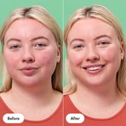 Hero Cosmetics Rescue Balm +Red Correct, 15ml