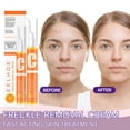 thumbnail image 2 of Gel eliminador de pecas, lápiz de crema antipecas, blanqueador con vitamina C, elimina eficazmente las manchas y las pecas, 15ML Fivean unisex, 2 of 2