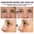 thumbnail image 3 of Jaysuing Eye Care Cream Reduces Fine Lines, Dark Circles, Eye Bags, Hydrating, Moisturizing And Firming Eye Cream, Anti-aging Skin Care, 3 of 5