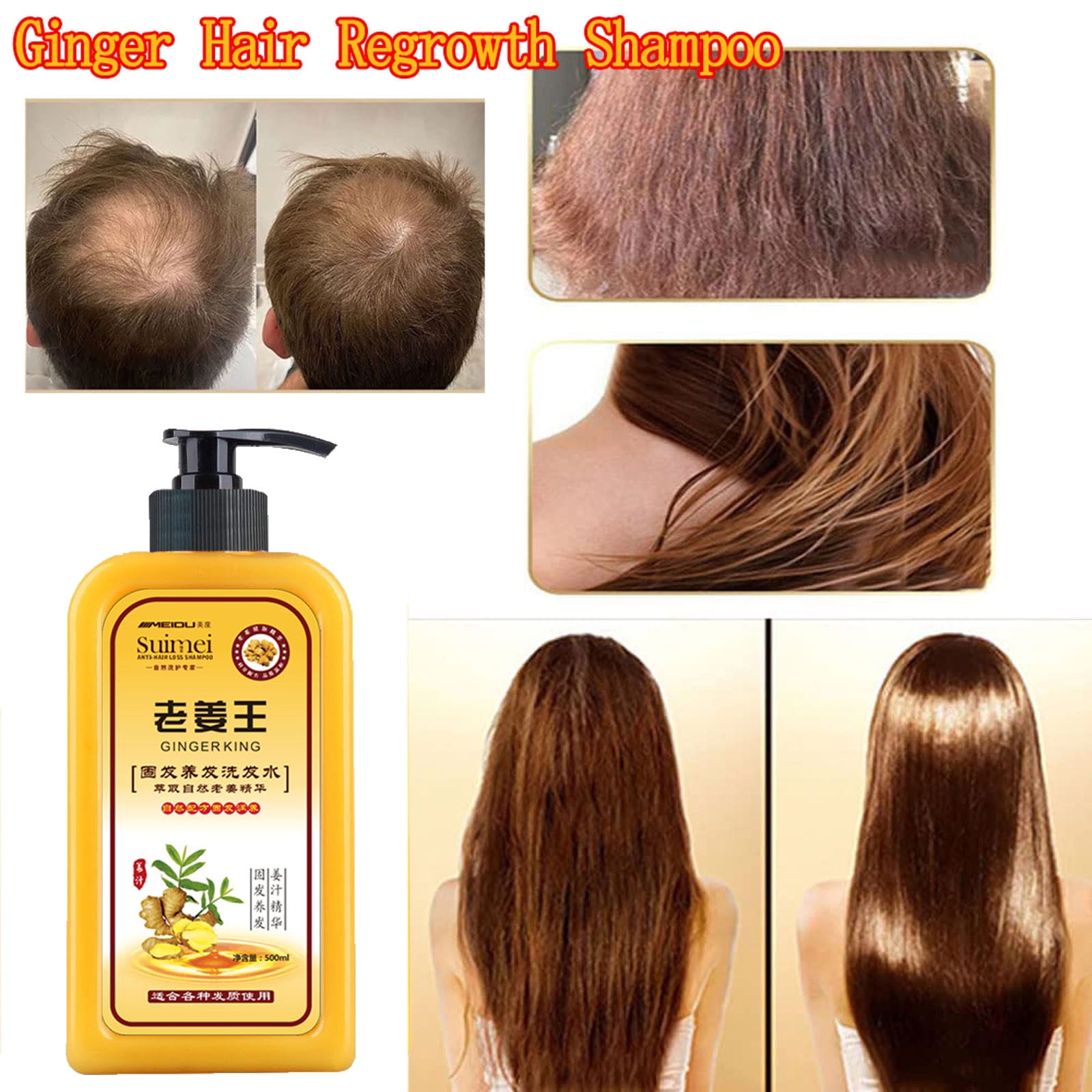 WUXICHEN Ginaday Instant Ginger Hair Regrowth Shampoo, 500ml Ginger