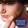thumbnail image 4 of PanOxyl Daytime Invisible Patches, Blemish Protection, Latex-Free 40ct, 4 of 15