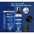 thumbnail image 5 of Spray para el crecimiento del cabello con 6% Minoxidil, spray para el tratamiento del crecimiento del cabello con Minoxidil para un crecimiento del cabello más fuerte, más grueso y más largo, 5 of 5