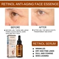 thumbnail image 3 of Sérum Visage au Rétinol 30 ml - Traitement des Rides et de l'Acné pour une Peau Éclatante - Sérum au Rétinol Haute Résistance pour le Visage, 3 of 5