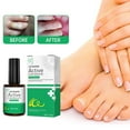 COCEQUC Effectively Remove Foot Corn Care Cream Remove Foot Mild