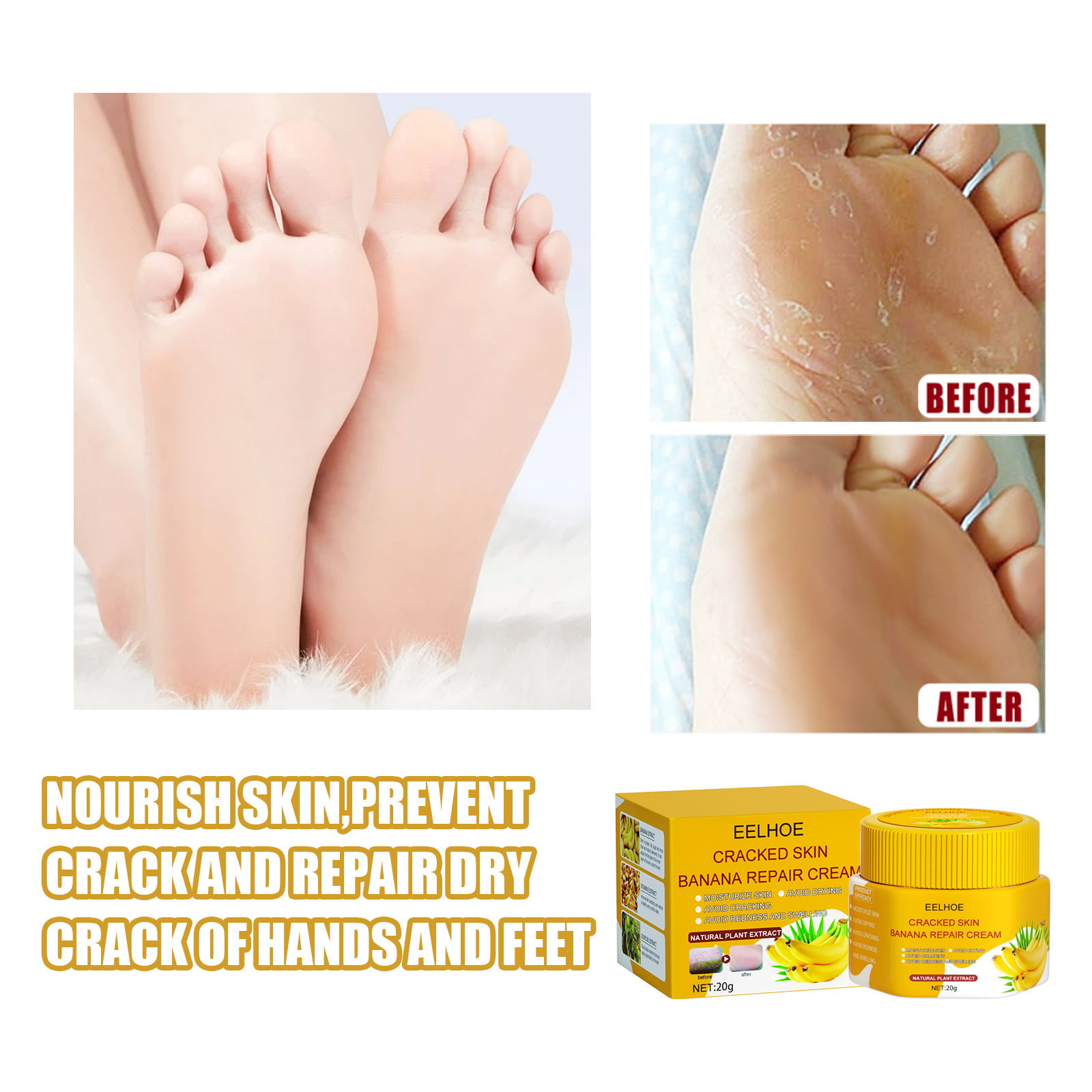 FootCream For Rough, Dry and Cracked Heel | Feet Cream For Heel Repair  |Healing & softening cream| aloevera foot cream | foot crack cream | foot  crack for tired heel|heel crack cream |- (50 gm.)