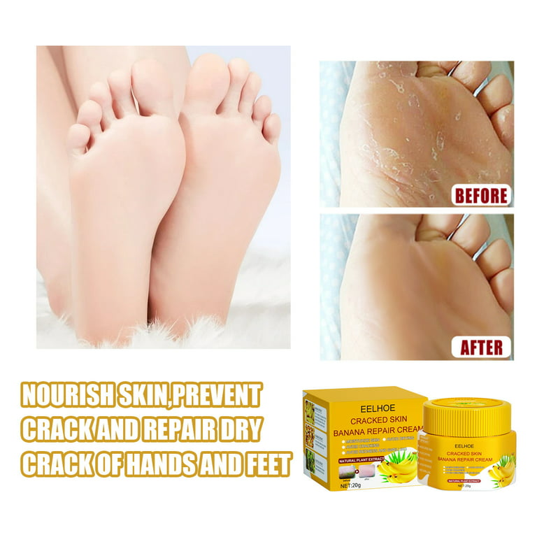 7 Days Foot Heel Crack Remover Cream Dry & Cracked Heel, Soothes Sore 100 gm