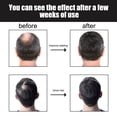 thumbnail image 4 of Gel para cabello grueso con ginseng | Prevención y crecimiento de la caída del cabello | Minodil Fórmula Nutritiva Mejorada | Acondicionador humectante | Engrosamiento y fortalecimiento | Reduce las, 4 of 8