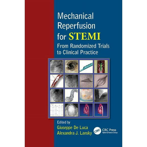 Mechanical Reperfusion for Stemi: From Randomized Trials to Clinical Practice, (Paperback)