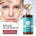 thumbnail image 5 of Scars Repair Cream Effective Acnes Scars Removal Cream for Women Men, 5 of 5