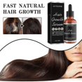 thumbnail image 2 of Jaysuing Dense Hair Essence Strong And Tough Hair Fixing Hair Root Thick Hairline Moisturizing Hair Essence |, 2 of 4