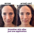 thumbnail image 6 of Skywee  Facial Patches for Wrinkles, Facial Wrinkle Smoothing Patches, Forehead Wrinkle Remover Strips Clear (180 Strips), 6 of 6