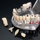 thumbnail image 4 of Consumibles dentales, modelo de restauración dental extraíble, modelo de diente patológico, modelo de diente móvil, modelo dental de implante, 4 of 4