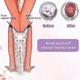 thumbnail image 5 of ZHAOCHENG Ducha vaginal, ducha anal, enema, jeringa de limpieza anal, limpiador de vagina, 5 of 5