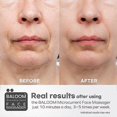 thumbnail image 3 of Microcurrent Facial Massage Roller - Skin Firming Treatment for Men and Women - Facial Wrinkle Reduction, Anti-Aging, Rejuvenation, Lifting, Acne Trea, 3 of 5