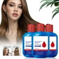 thumbnail image 2 of Selenium Disulfide Anti-Dandruff Shampoo Soothes Scalp, Controls Oil, for Dry & Oily Hair, 120ml/4oz, 2 of 5
