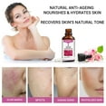 thumbnail image 3 of Aceite esencial SOLOTREE Rose 30 ml para suero antienvejecimiento facial, 3 of 7