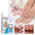 thumbnail image 2 of Nail Care Nail Repair Spray Repair And Clean Nails, Hands, Feet, Soft Nails, Thicken Nails, Polish Nails100ml, 2 of 5