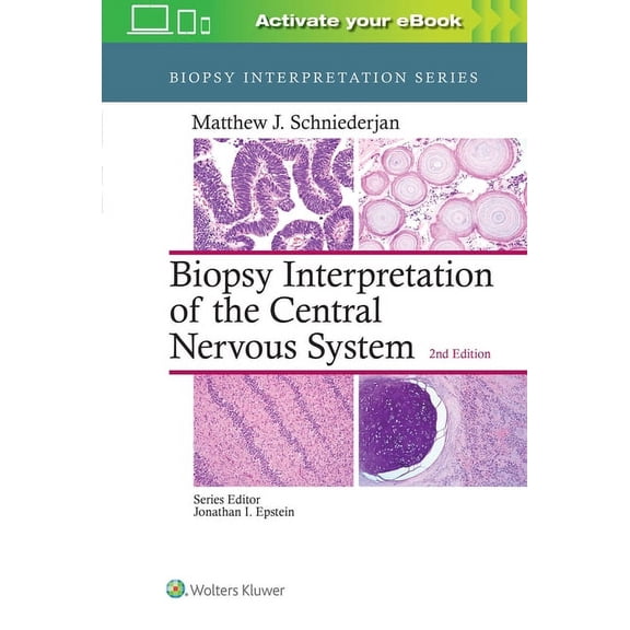 Biopsy Interpretation: Biopsy Interpretation of the Central Nervous System (Hardcover)