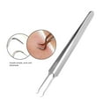 thumbnail image 5 of Yeacher 4Pcs Stainless Steel Blackhead Extractor Tool Facial Comedone Acne Blemish Remover Kit Set, 5 of 5