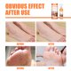 thumbnail image 5 of Beleza, Cuidado e Higiene EELHOE Reparación de pies Enfermería Spray Naranja Árbol de té Variour Fruta EELHOE 100ml, 5 of 7