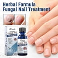 thumbnail image 1 of Formula Fungal Nail Paronychia Treatment Gel, Toenail Fungus Treatment, Extra Strength Nail Repair Solution For Finge, 1 of 5
