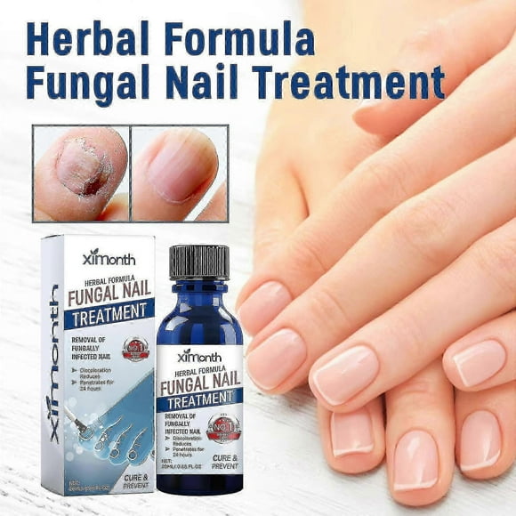 Formula Fungal Nail Paronychia Treatment Gel, Toenail Fungus Treatment, Extra Strength Nail Repair Solution For Finge