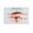 FRAMED12X18INCH(30X45CM), variant on The Facts on Dry Eye Poster Eye Hospital Wall Decorate (7) Canvas Painting Posters And Prints Wall Art Pictures for Living Room Bedroom Decor