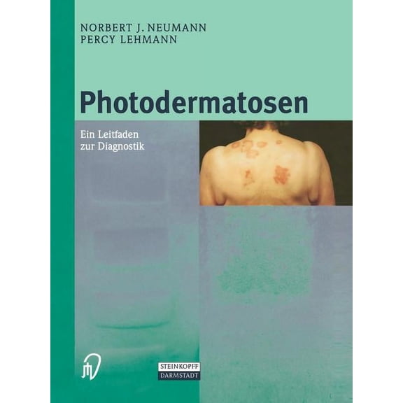 Photodermatosen: Ein Leitfaden Zur Diagnostik, (Paperback)