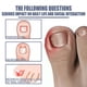 thumbnail image 3 of Líquido Reparador De Uñas Líquido reparador de uñas de 10 ml Líquido eficaz para uñas Multiusos para el cuidado de los pies, 3 of 8