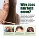 thumbnail image 5 of Ginseng Dense Hair Spray Ginseng Hair Dense Hair Dropping Fixed Hair Conditioner Moisturizing Hair Spray 30ml, 5 of 9