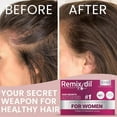 thumbnail image 7 of Hair Growth Vitamins for Visibly Thicker & Stronger Hair - Supplements for Hair Loss Treatment and Thinning Hair in Women, 7 of 7