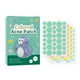 thumbnail image 3 of Parches para Granos (144 Unidades) | Parches Cicatrizantes con Forma de Estrella | Parches para Granos | Ingredientes Naturales | Seguro para Piel Sensible | 144 Adhesivos para La Piel, 3 of 7
