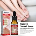 thumbnail image 2 of Aceite esencial para uñas encarnadas: kit para aliviar el dolor y suavizar uñas encarnadas, fácil de recortar con gel de silicona., 2 of 3