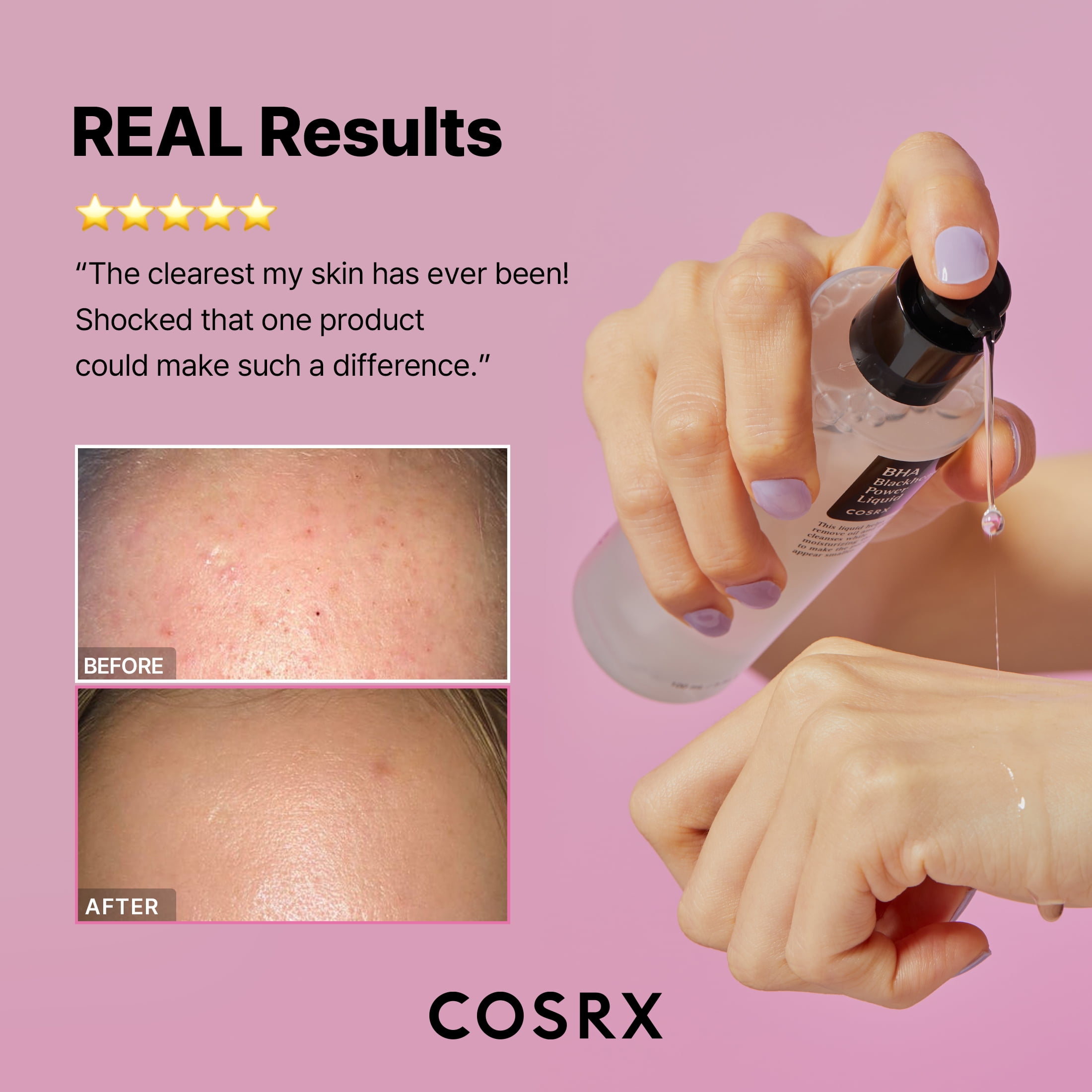 COSRX BHA Blackhead Power Liquid (3.38 fl.oz)