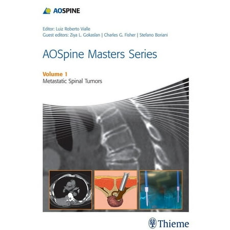 UPC: 9781626230460 | Aospine Masters: Aospine Masters Series Volume 1: Metastatic Spinal Tumors (Hardcover)