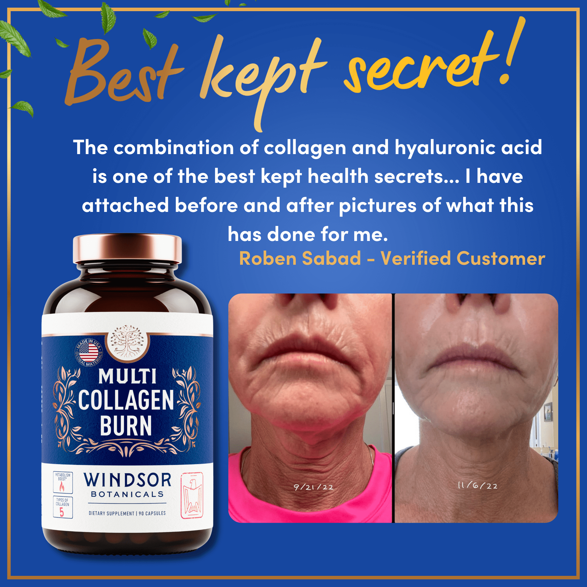 Thermogenic Multi Collagen Burn Capsules - Hydrolyzed Multi Collagen Complex Types I, II, III, V, X, Marine Collagen, Hyaluronic Acid - Beauty and Anti-Aging Supplement for Women and Men - 180 Pills