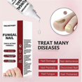 thumbnail image 3 of 15ml Fungi Nail Treatment Liquid Fast-acting Nail Repair Strengthening Liquid Nails Care Supplies, 3 of 5