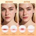 thumbnail image 7 of Pimple Patches for Face, Hydrocolloid Acne Patches, Cute Star Zit Covers, Colorful Superstar Patches Spot Stickers, 102 Count | 4 Sizes (8mm/9mm/11mm/14mm), 7 of 7