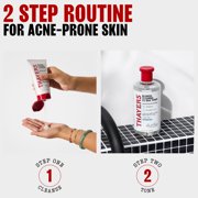 THAYERS Blemish Clearing Salicylic Acid Toner, Acne Treatment Face Toner with 2% Salicylic Acid, Soothing and Non-Stripping Skin Care 12.0 fl. oz.