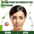3 Pack Acne Treatment Cream For Teens Adults Acne Treatment With 3-pack-acne-treatment-cream-for-teens-adults-acne-treatment-with