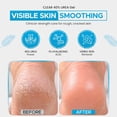 thumbnail image 2 of CLEAR 40 HA, Urea Cream 40% + 1% Hyaluronic Acid (8 oz) | | Softens Cracked Heels & Dry Skin Urea Cream 40 Percent - Tea Tree & Coconut Oil | Urea Cream for Callus & Corn Treatment | Made in USA, 2 of 7