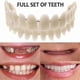 thumbnail image 1 of Smile Snap Upper Denture Denture Veneers Dental Braces, 1 of 5