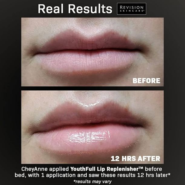 Revision YouthFull Lip Replenisher 0.33 oz / 9.4 g - Walmart.ca