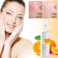 thumbnail image 4 of Fiudx Limpiador Facial Orange Vc: Un Pequeño y Práctico Cabezal de Cepillo Suave Que Limpia y Masajea El Rostro En Cualquier Momento. Limpieza Facial Profunda de 150 Ml., 4 of 6